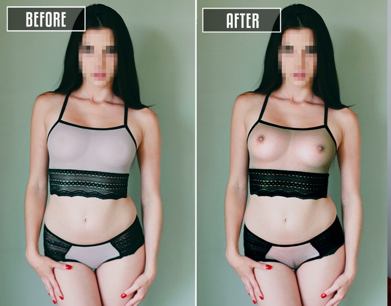 xray fake nude